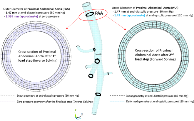 Deformation of Cross-Section at the Proximal Abdominal Aorta Location for Various Pressure Conditions