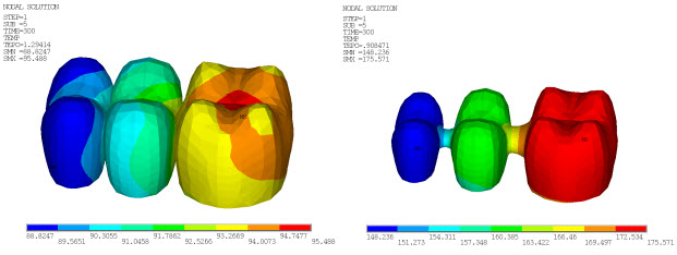 Temperature Distribution in Veneer and Core at 300 Seconds