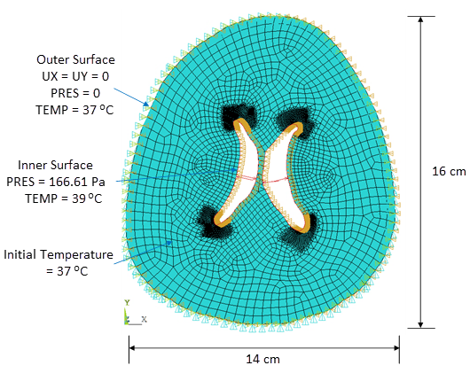 Schematic of Brain Axial Section with Boundary Conditions