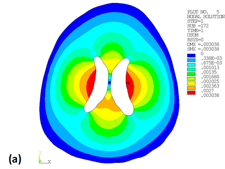 Deformation Contour of the Last Time Step (a) and Deformed / Undeformed Shapes (b)