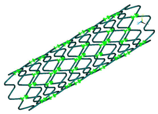 Stent Model 3D Expanded Solid Display