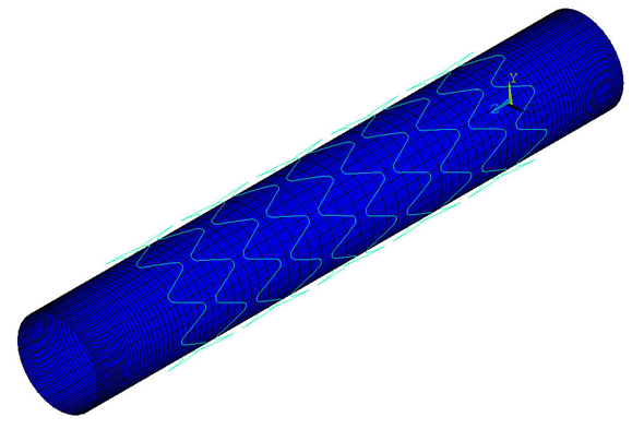 Standard Line-to-Surface Contact Between Stent and Inner Plaque Wall