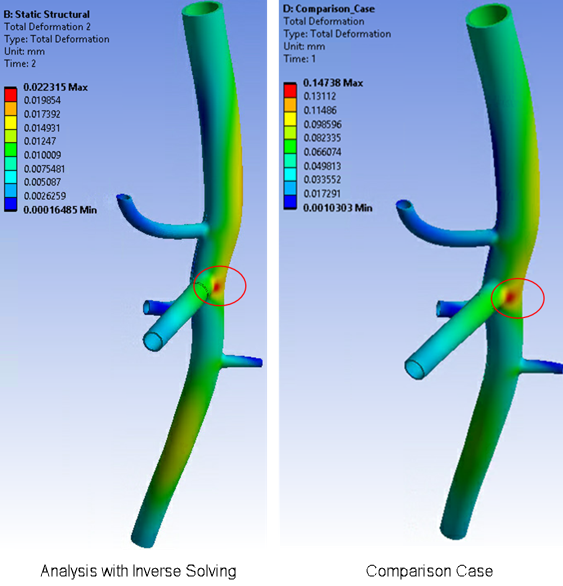 Comparison of Total Deformation (USUM) at End-Systolic Pressure (120 mm Hg)