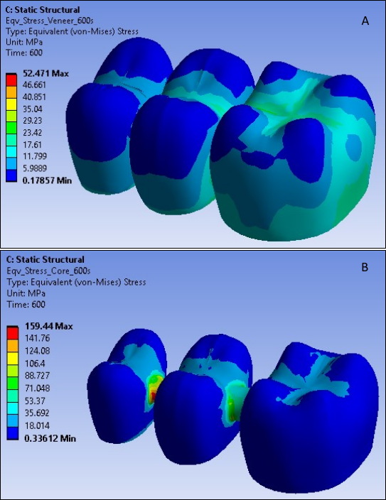 Von Mises Stress in Veneer and Core at 600 Seconds