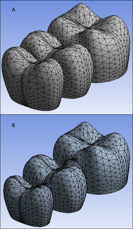 FPD Veneer (A) and Core (B) Mesh (SOLID291)