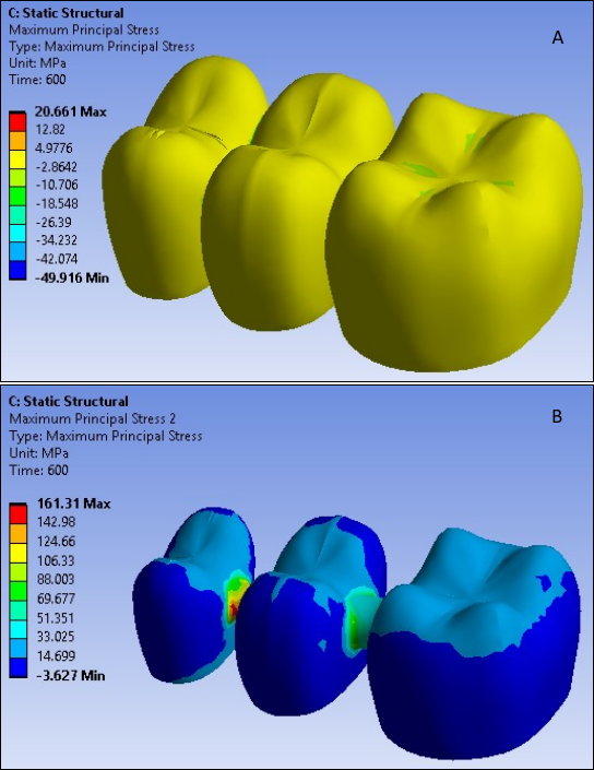 Reference Results: Residual Principal Stress Distribution in Veneer and Core