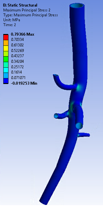 Maximum Principal Stress After Forward Solving (Second Load Step)