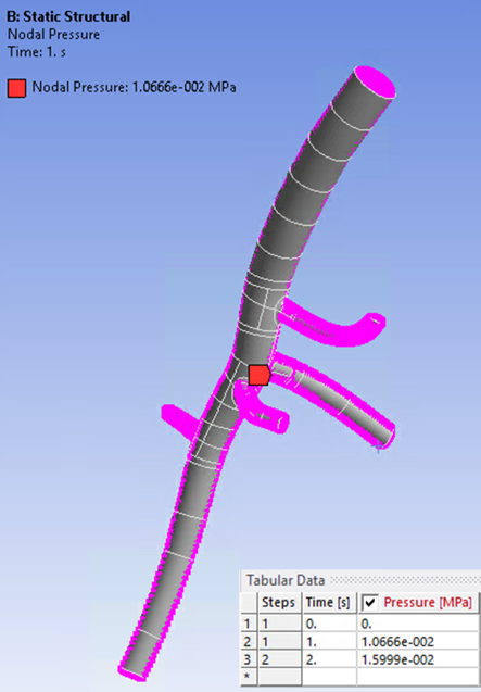 Loading on the Abdominal Aorta Model