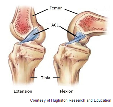 Human Knee Components