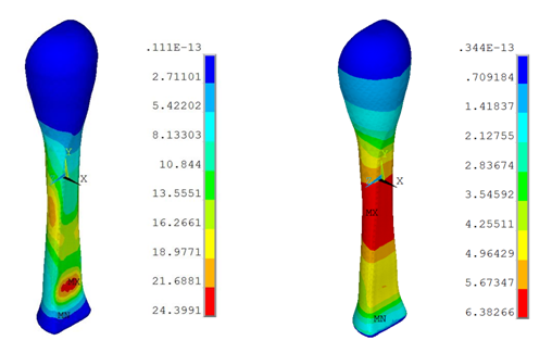 Von Mises Stress (Anisotropic Visco-Hyperelastic and Neo-Hookean Viscoelastic)