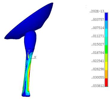 Von Mises Stresses Under 11.25° Knee Rotation