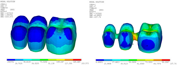 Von Mises Stress in Veneer and Core at 60 Seconds