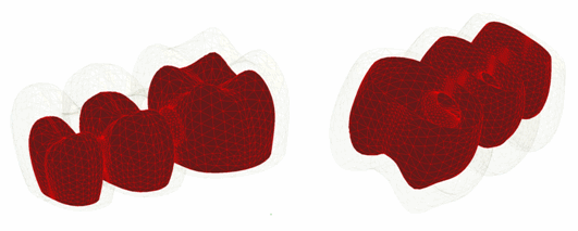 Contact Between Veneer and Core (CONTA174 and TARGE170)