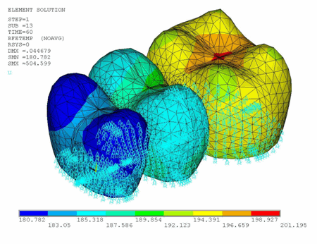 FPD Boundary Conditions: Structural Analysis