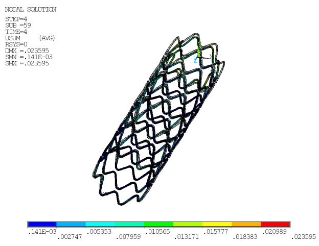 Stent Retraction Resulting from Arterial Compression