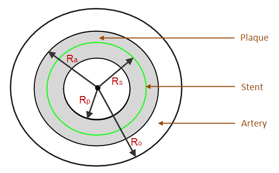 Cross-sectional View of Unloaded Artery and Stent