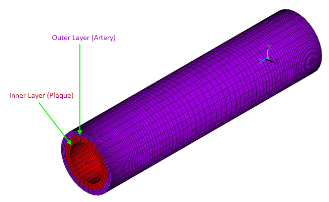 Simplified Atherosclerotic Artery Model