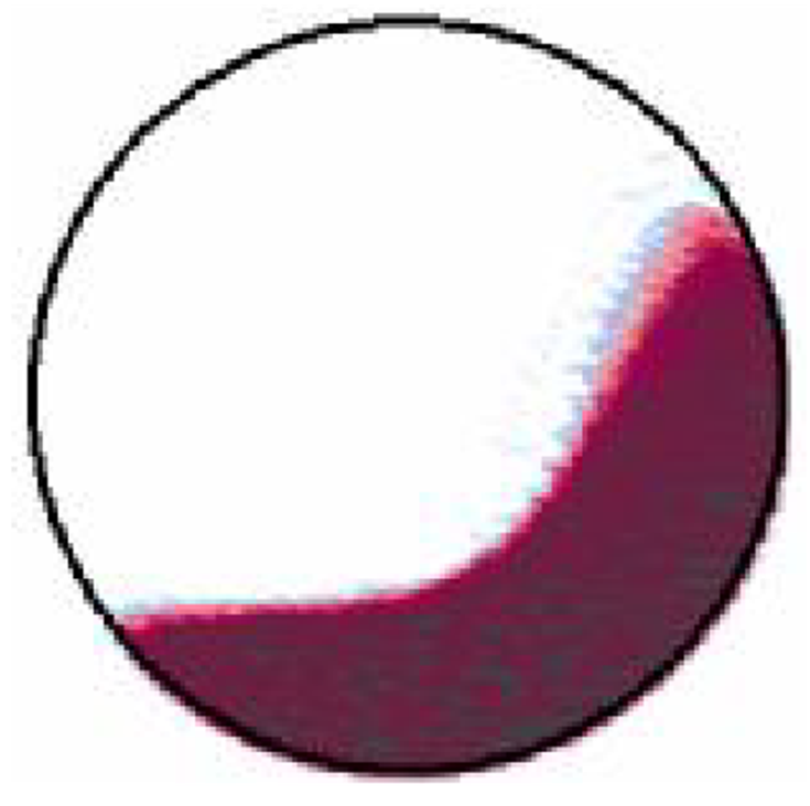 Kalala (2008) Simulation Load Angles