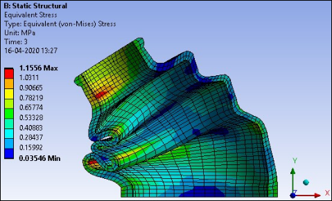 Von Mises Stress at the Maximum Shaft Angle