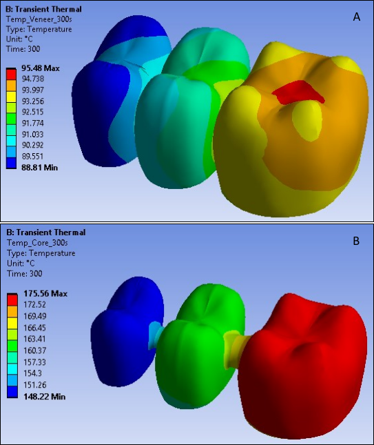 Temperature Distribution in Veneer and Core at 300 Seconds