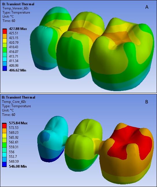 Temperature Distribution in Veneer (A) and Core (B) at 60 Seconds