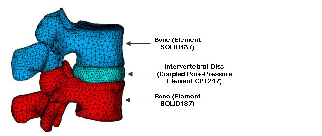 Finite Element Model of a Human Lumbar Motion Segment