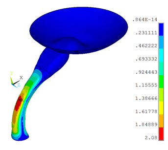 Von Mises Stresses Under 45&deg; Knee Flexion