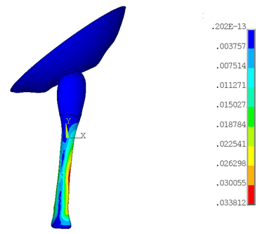 Von Mises Stresses Under 11.25&deg; Knee Rotation
